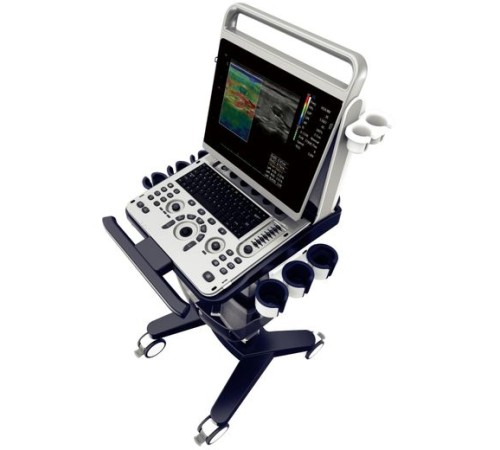 Chison SonoTouch 60 Chison SonoTouch 60