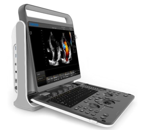 Chison SonoTouch 60 Pro Chison SonoTouch 60 Pro