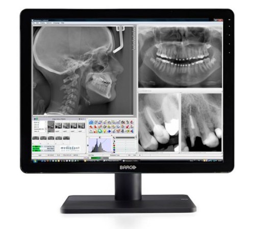 Barco Nio Color 3MP Dental Barco Nio Color 3MP Dental